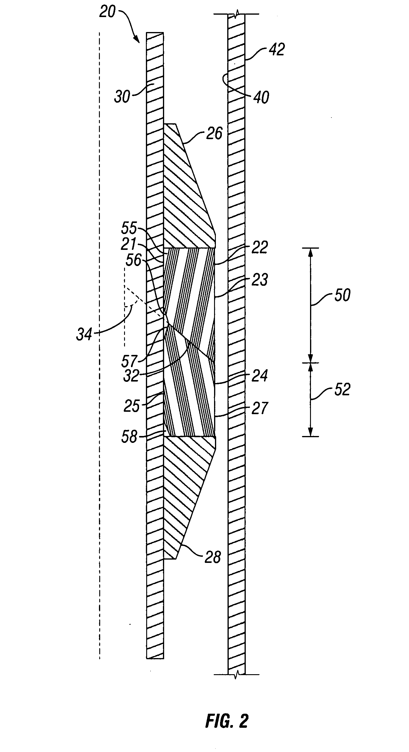 Non-backed-up packing element system