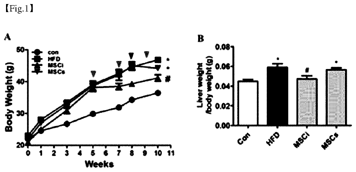 Pharmaceutical composition for preventing or treating obesity or non-alcoholic fatty liver, containing dental tissue-derived multipotent stem cells