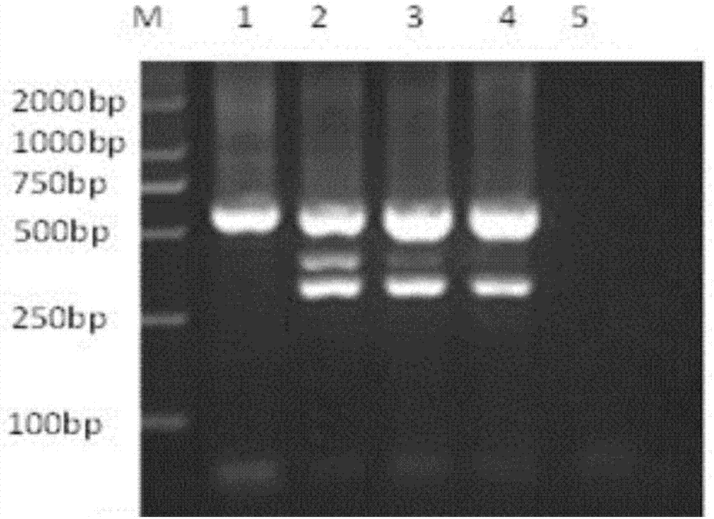 Multiple nested PCR (polymerase chain reaction) detection primer, kit and method for Neospora caninum, Brucella abortus and infectious bovine rhinotracheitis virus