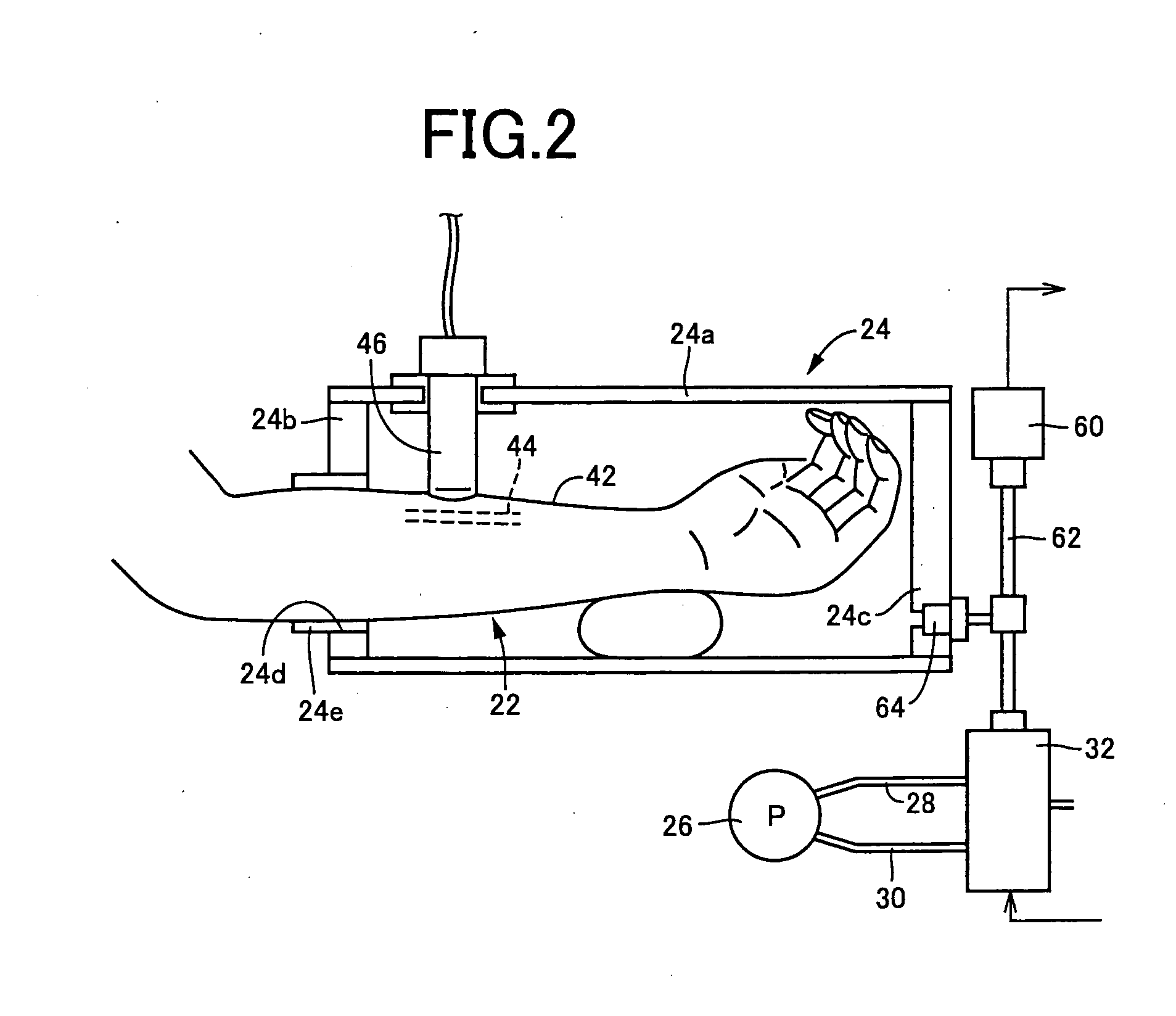 Biological luminal body evaluating apparatus