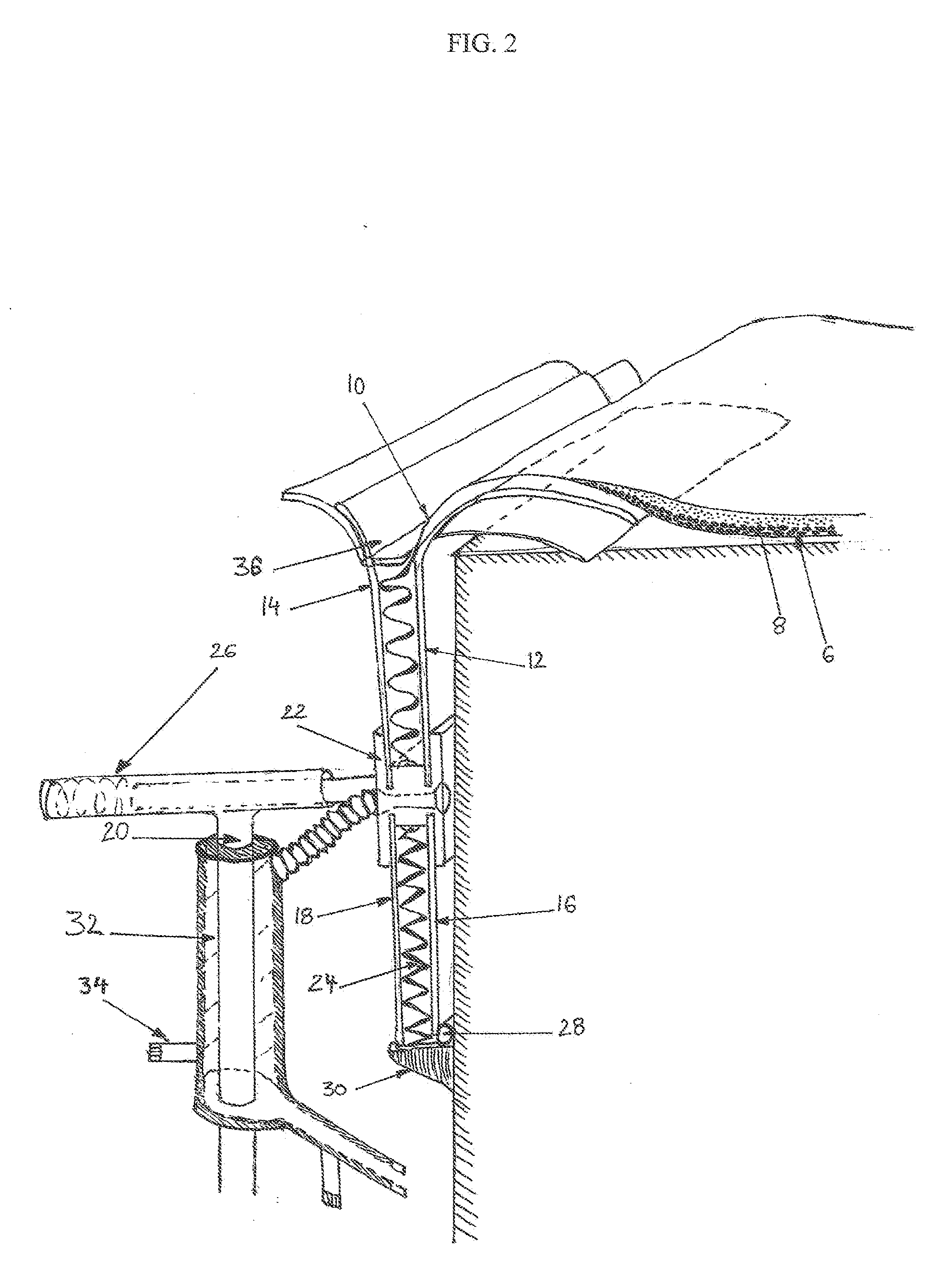 Atmospheric retention passive system for nuclear buildings