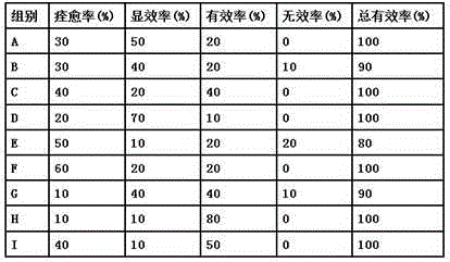 Traditional Chinese medicine acupoint injection for treating migraine and preparation method of traditional Chinese medicine acupoint injection