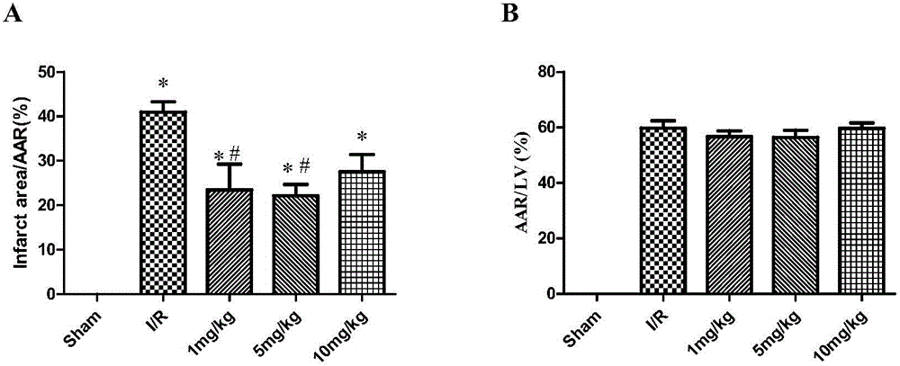 Application of ginsenoside Rg1 to preparation of medicines for prevention and/or treatment of myocardial ischemia