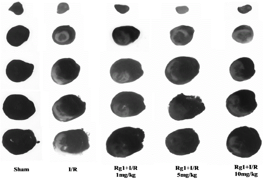 Application of ginsenoside Rg1 to preparation of medicines for prevention and/or treatment of myocardial ischemia