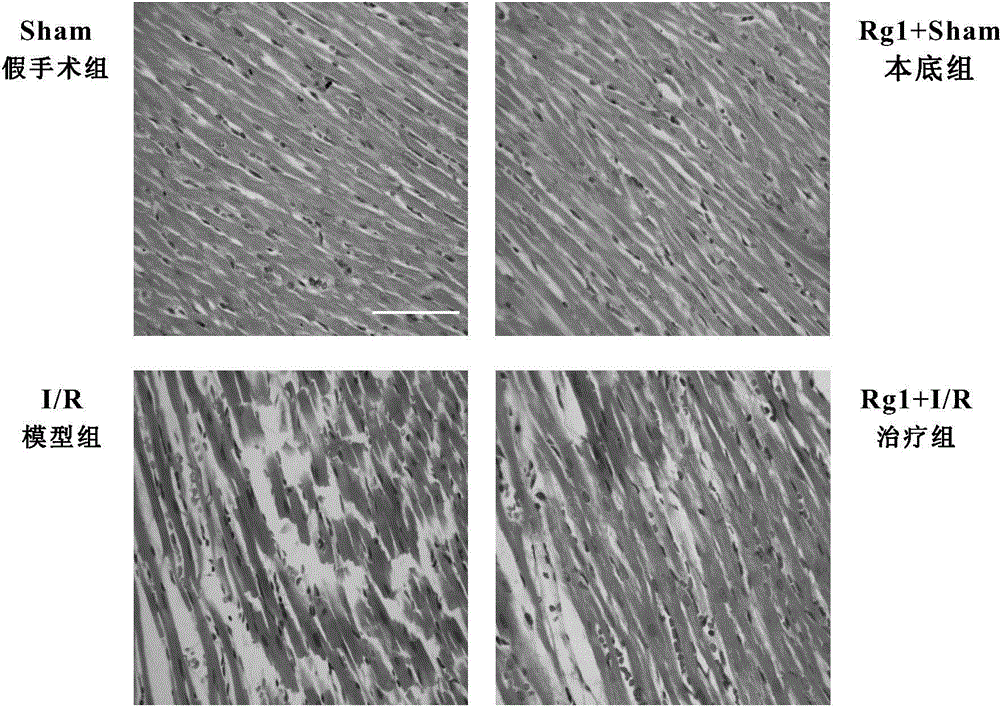 Application of ginsenoside Rg1 to preparation of medicines for prevention and/or treatment of myocardial ischemia