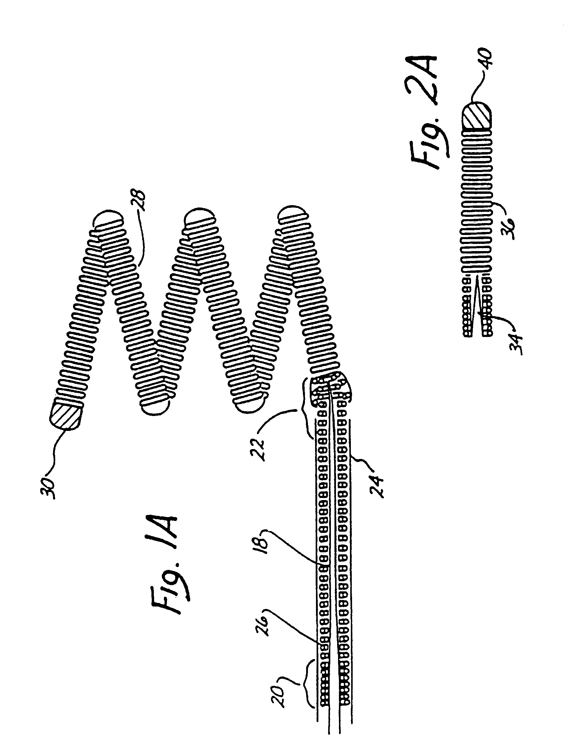 Endovascular electrolytically detachable wire and tip for the formation of thrombus in arteries, veins, aneurysms, vascular malformations and arteriovenous fistulas