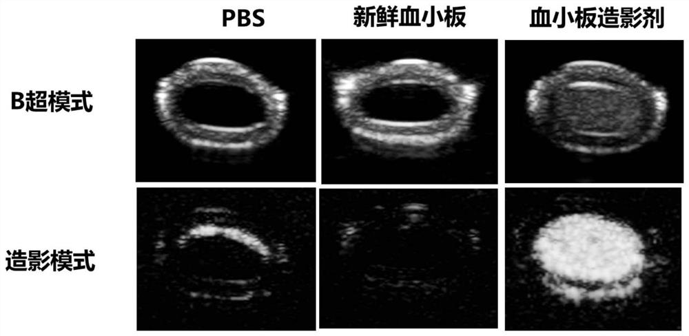 Preparation and Application of Ultrasonic Contrast Agents Derived from Natural Cell Membranes