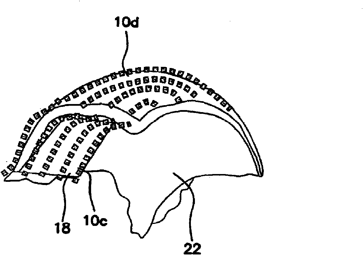 An apparatus and method for in vivo intracellular transfection of gene, sirna, shrna vectors, and other biomedical diagnostic and therapeutic drugs and molecules for the treatment of arthritis and oth