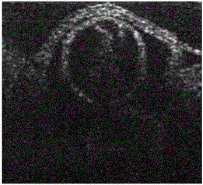 Horizontal set image segmentation method of frequency-domain boundary energy model