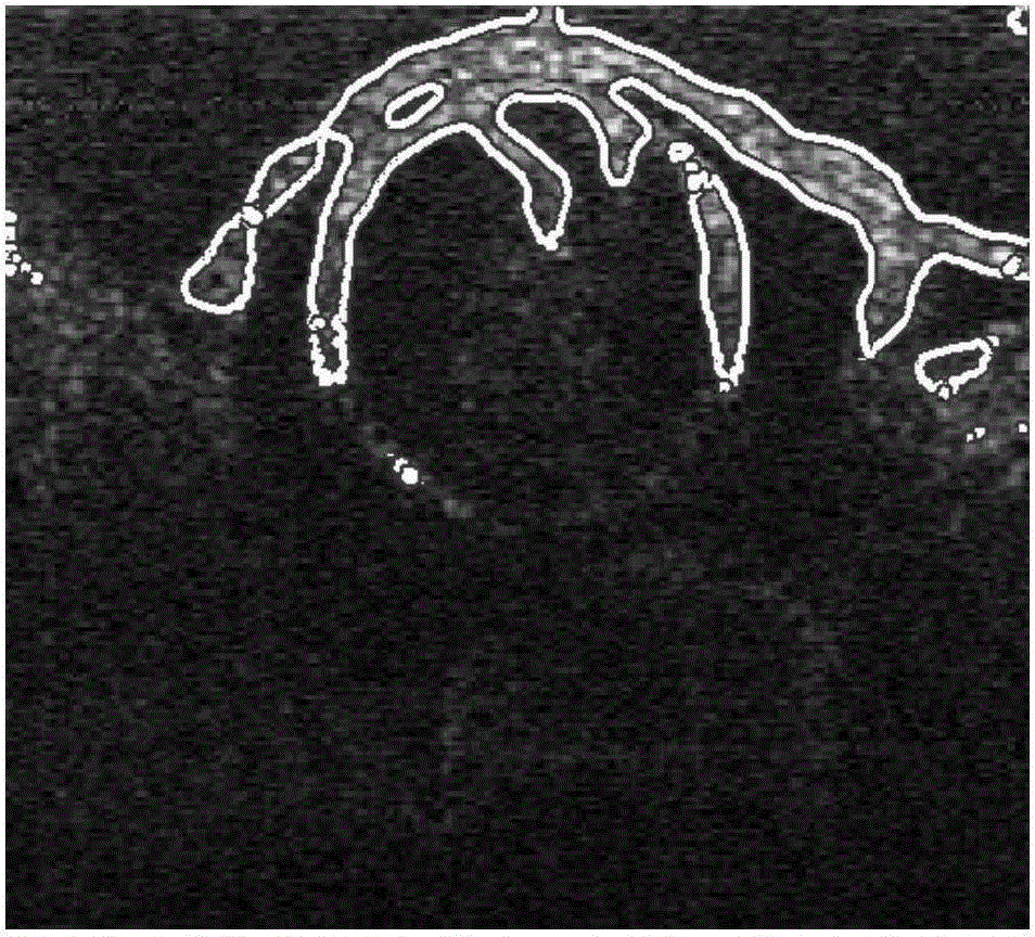 Horizontal set image segmentation method of frequency-domain boundary energy model