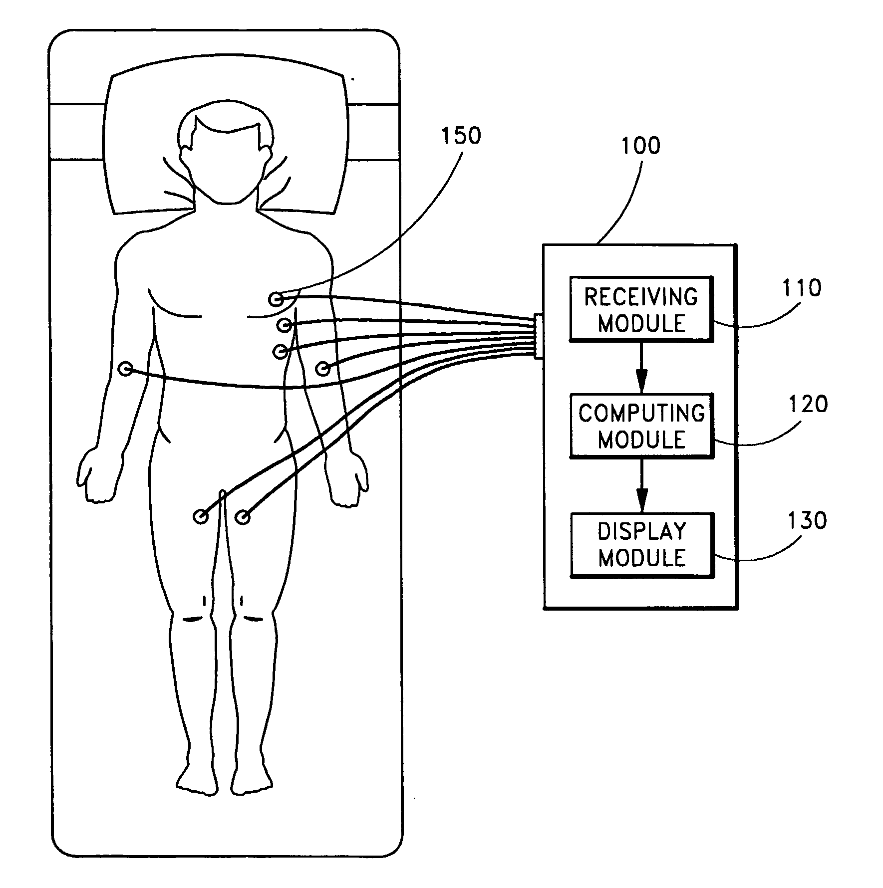 System and method for separating cardiac signals