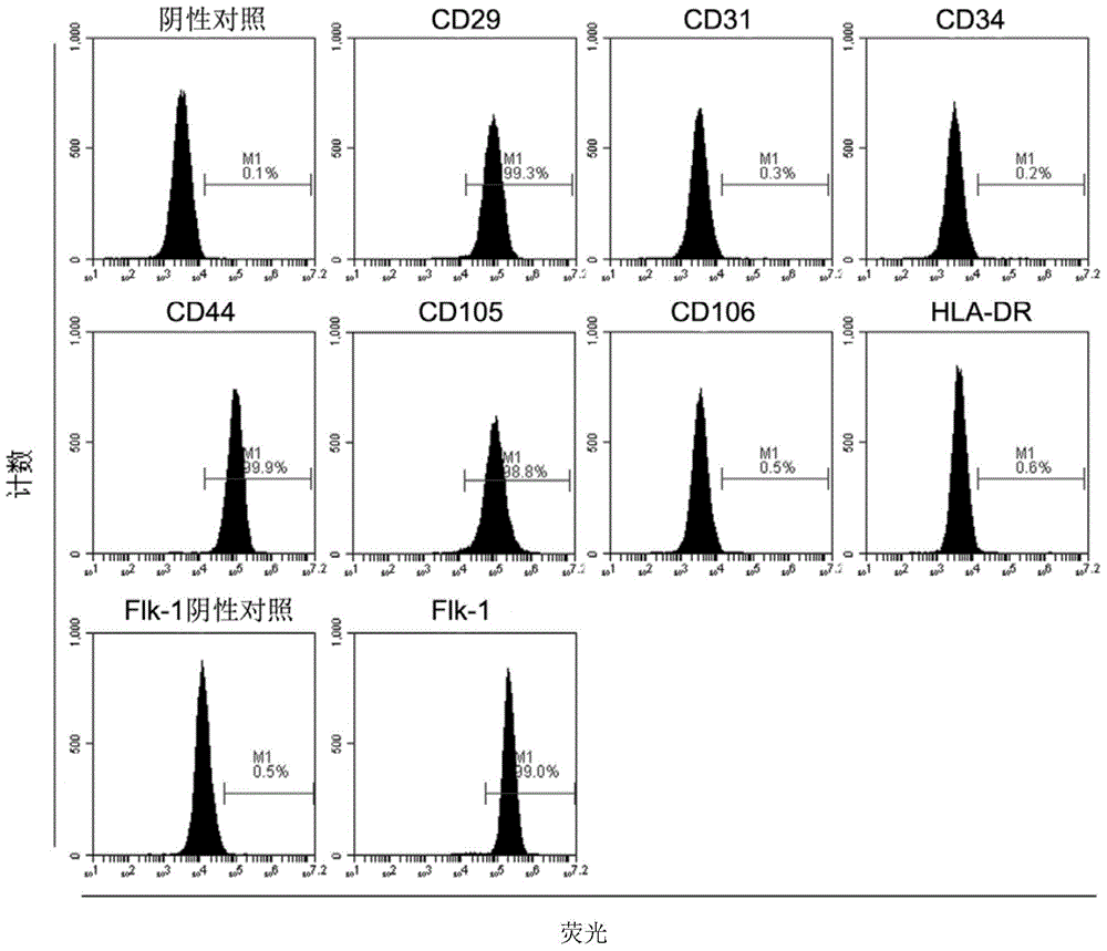 Preparation method of kidney sertoli cells and special mediums thereof