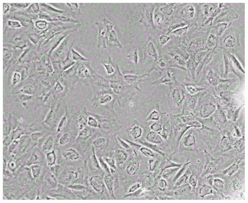 Preparation method of kidney sertoli cells and special mediums thereof