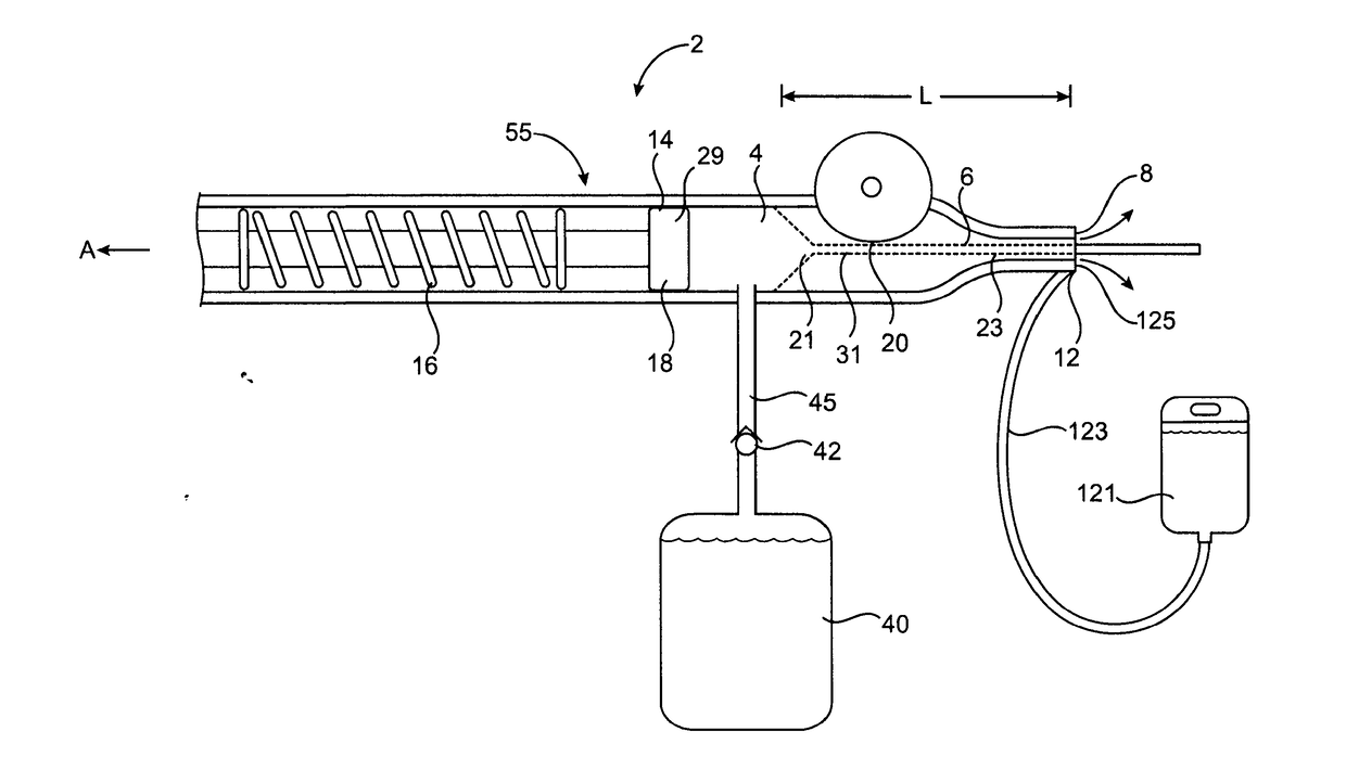 Devices and methods for ocular surgery