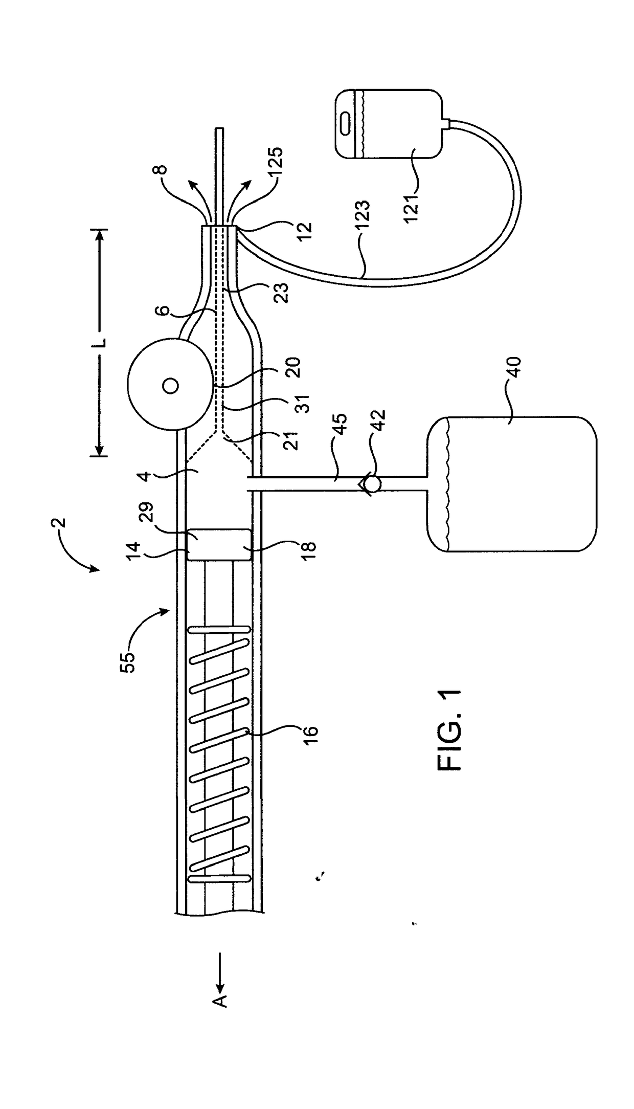 Devices and methods for ocular surgery