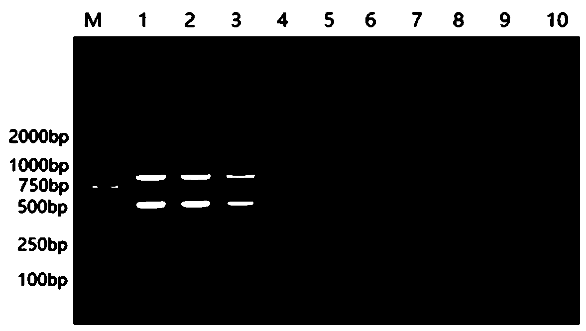 Primer set for detecting bovine norovirus and bovine coronavirus and double RT-PCR method