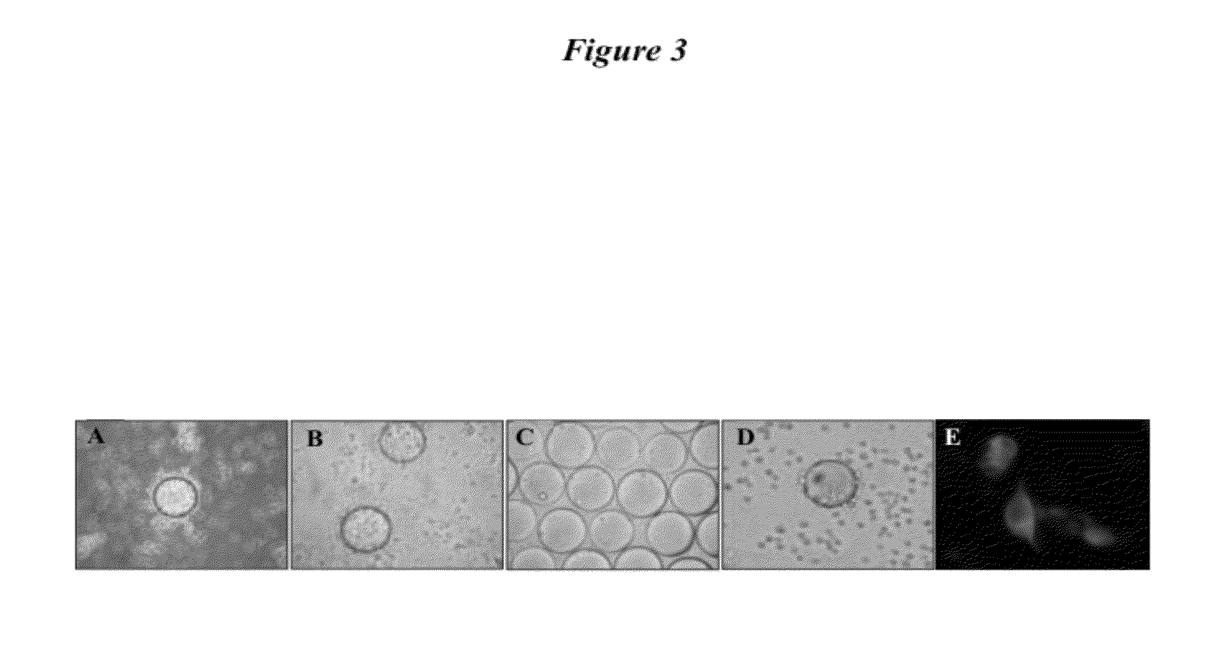 Bladder cancer specific ligand peptides