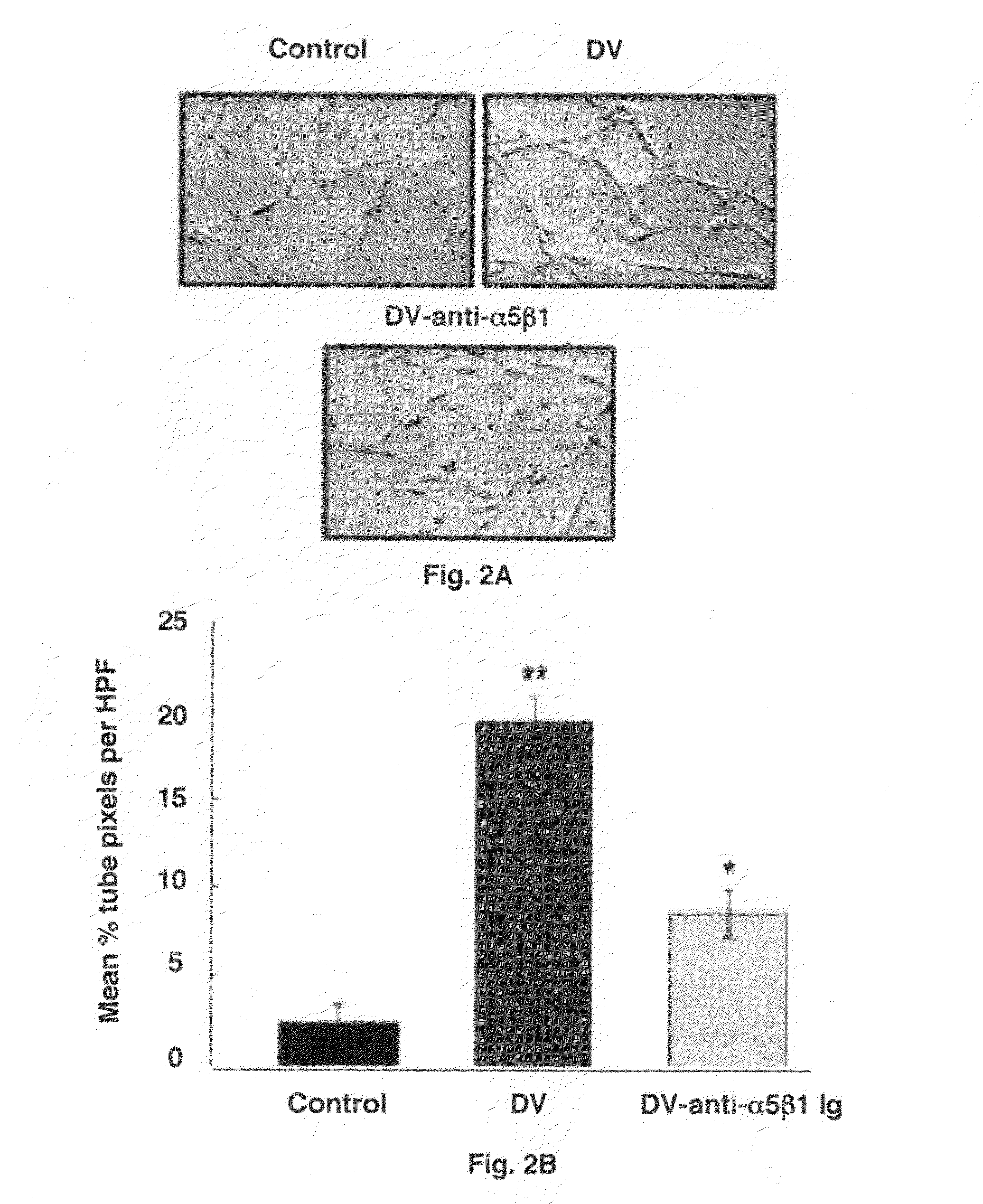 Stroke-generated angiogenesis enhancers and uses thereof