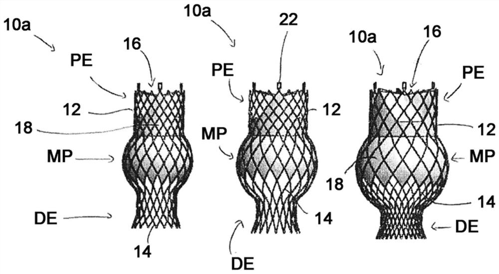 Self-expanding stent and stent set