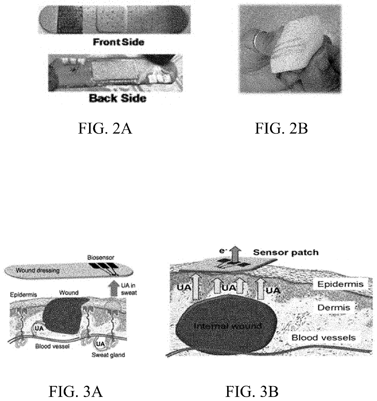 Wound monitoring sensors and use thereof