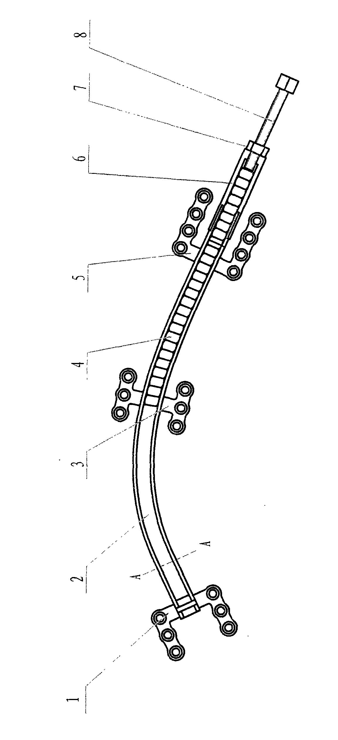 Built-in arc-shaped distraction osteogenesis device