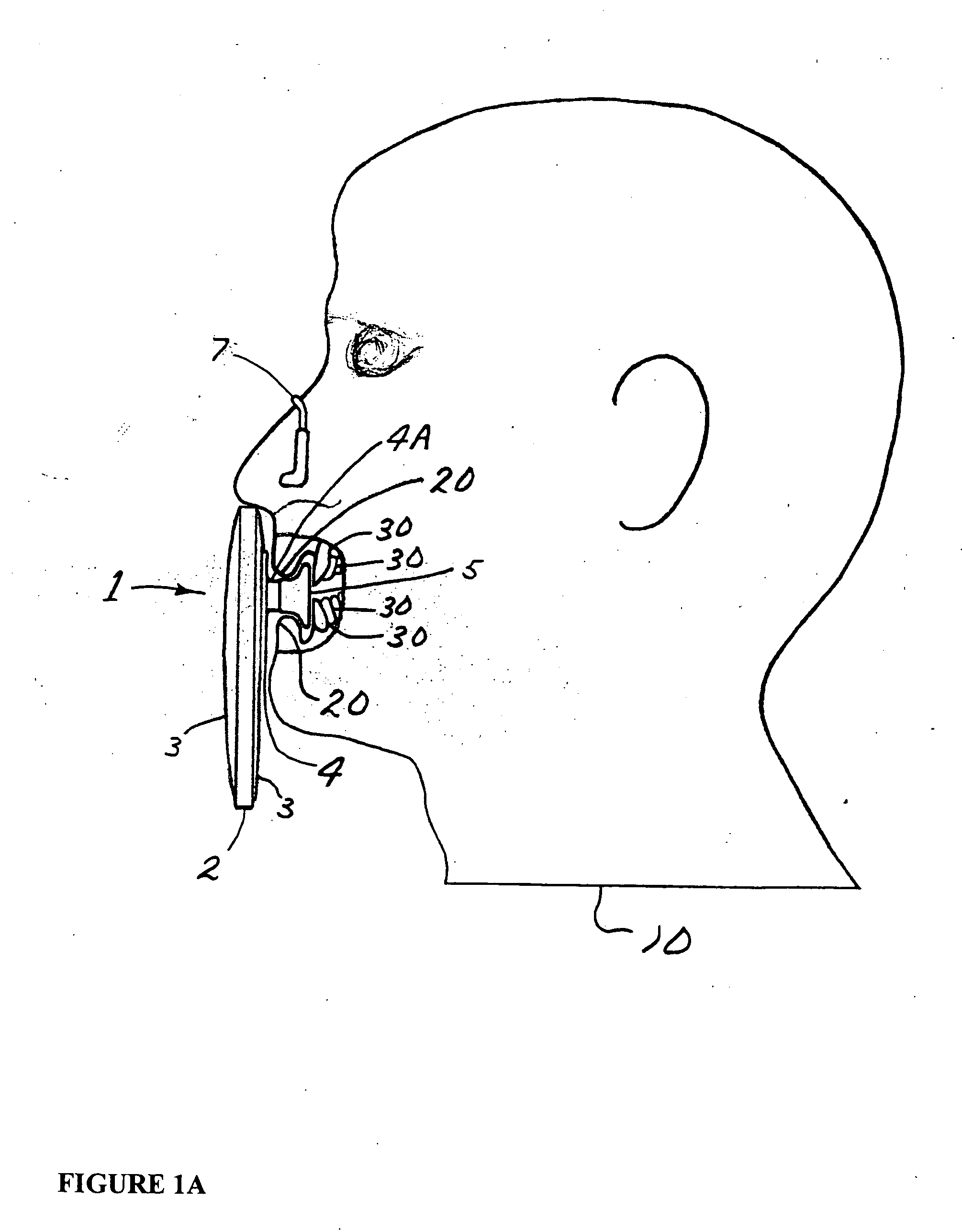 Personal respirator