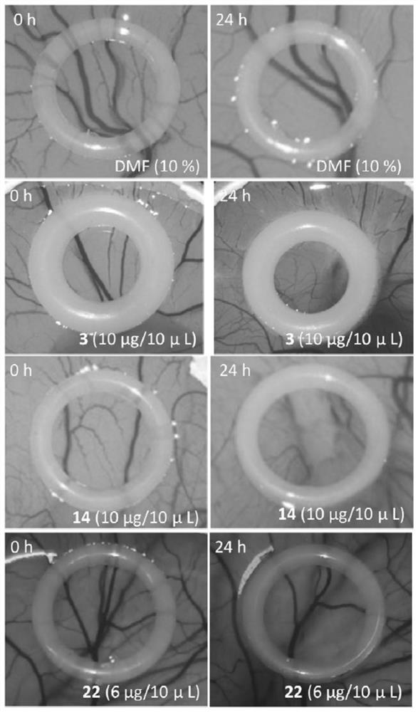 Metal complex containing tridentate ligand and xanthine derivative ligand and preparation method and medical application of metal complex