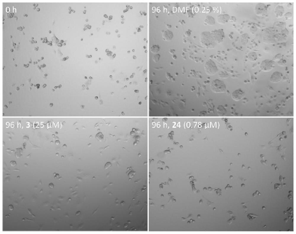 Metal complex containing tridentate ligand and xanthine derivative ligand and preparation method and medical application of metal complex