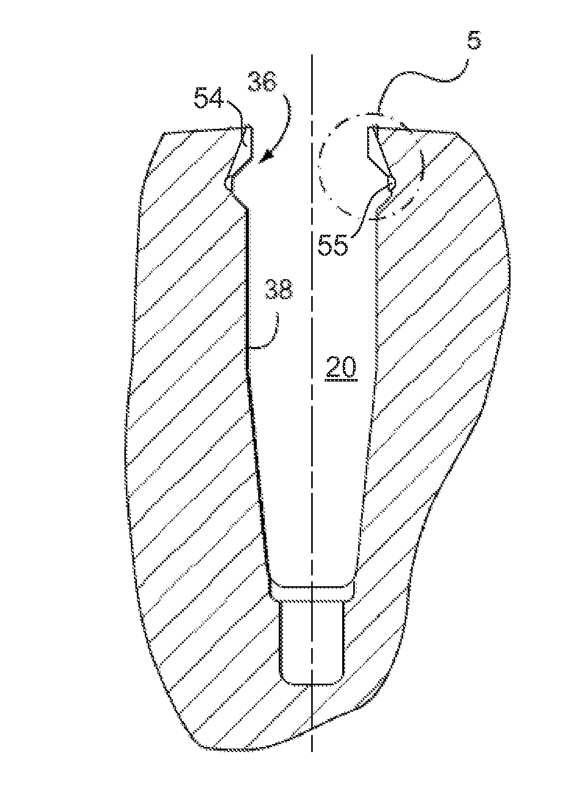 Generator rotor fretting fatigue crack repair method