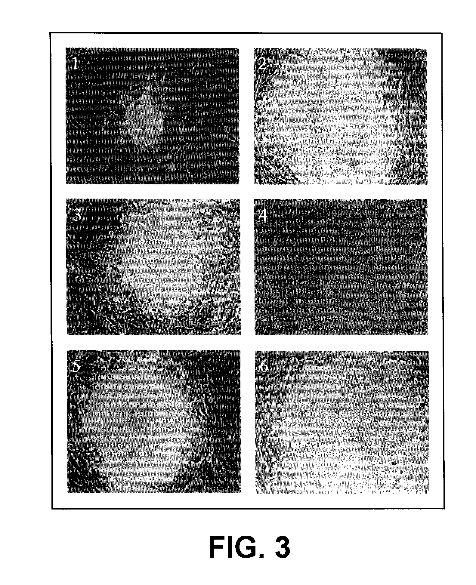 In Vitro Generation of Hepatocytes from Human Embryonic Stem Cells