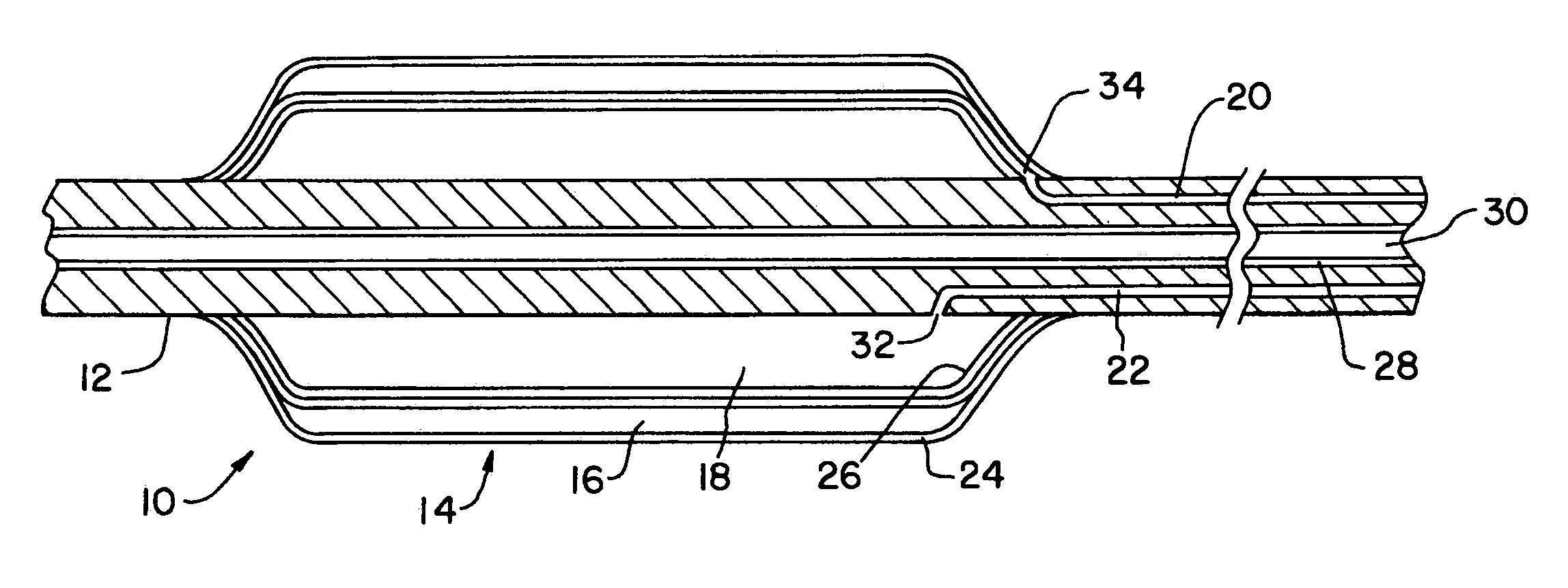 Catheter with concentric balloons for radiogas delivery and booster radiosources for use therewith