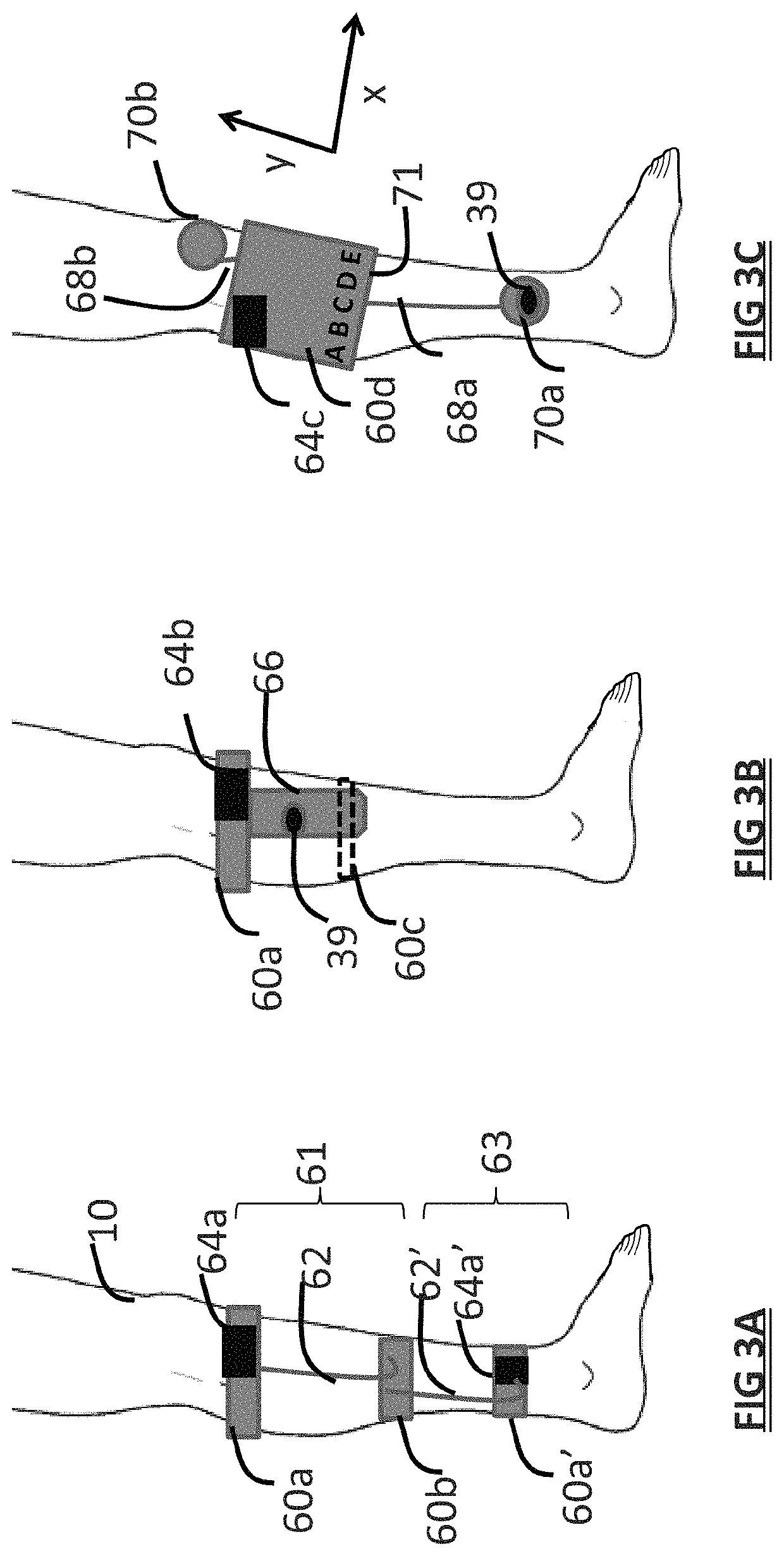 Systems and methods for assessing pelvic floor disorder therapy