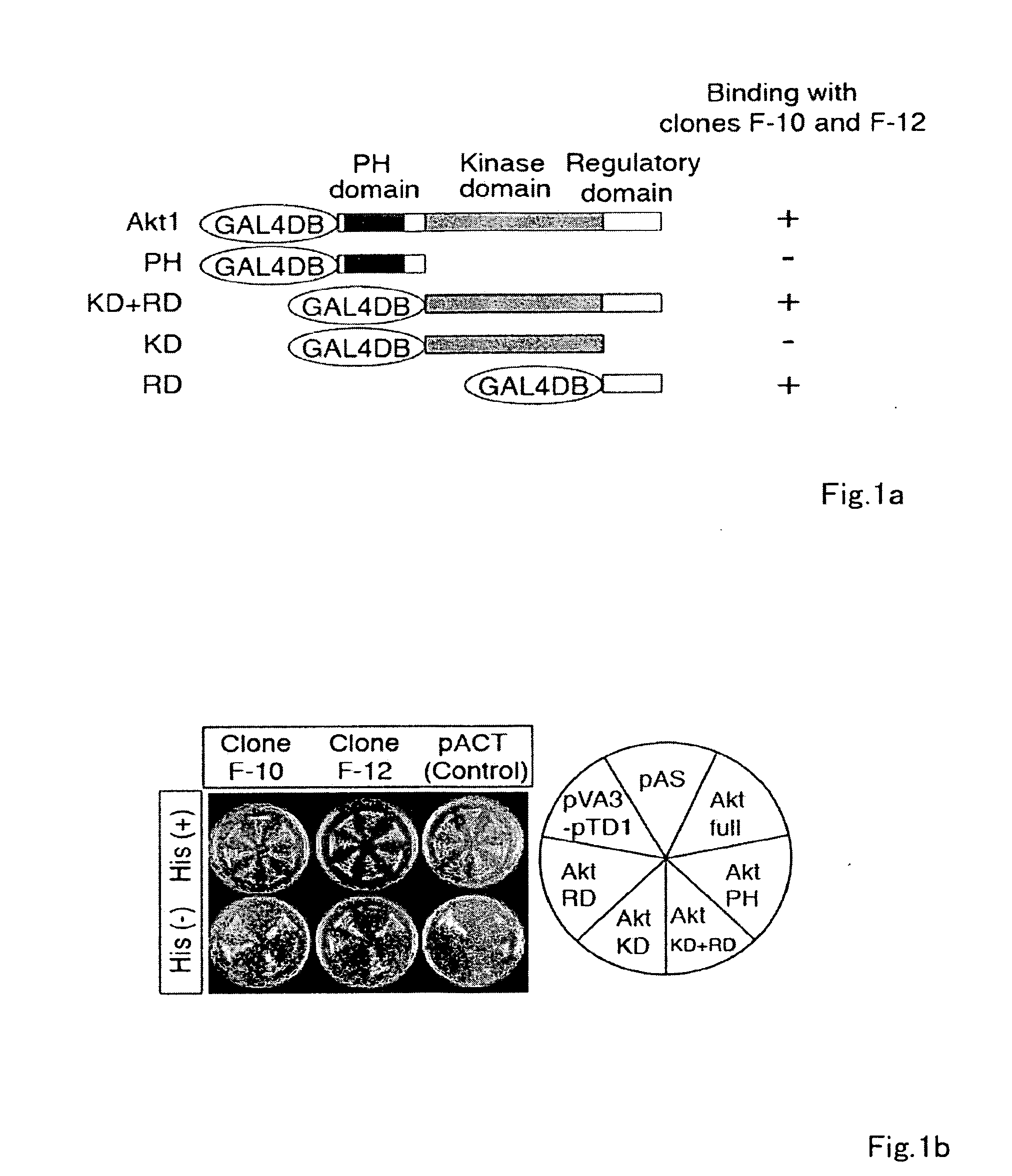 Antibodies against actin-binding protein girdin and methods of making and using the same