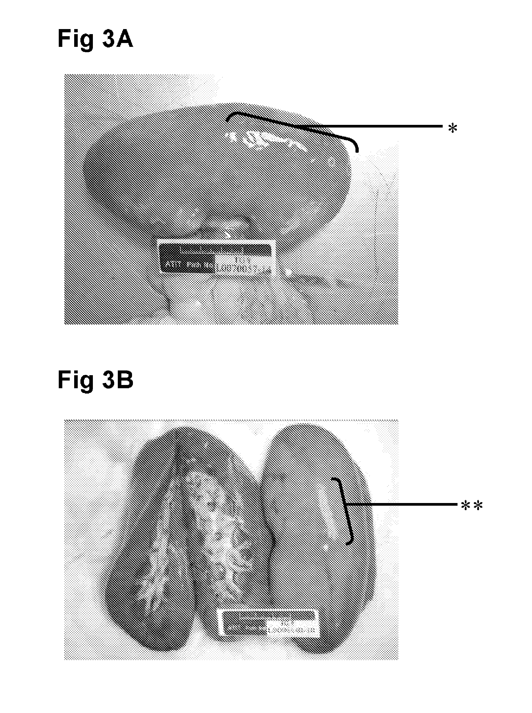 Designer peptide-based pcv2 vaccine