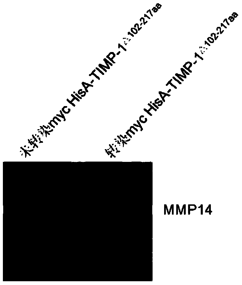 Anti-cav peptide analogue and corresponding cdna and its application