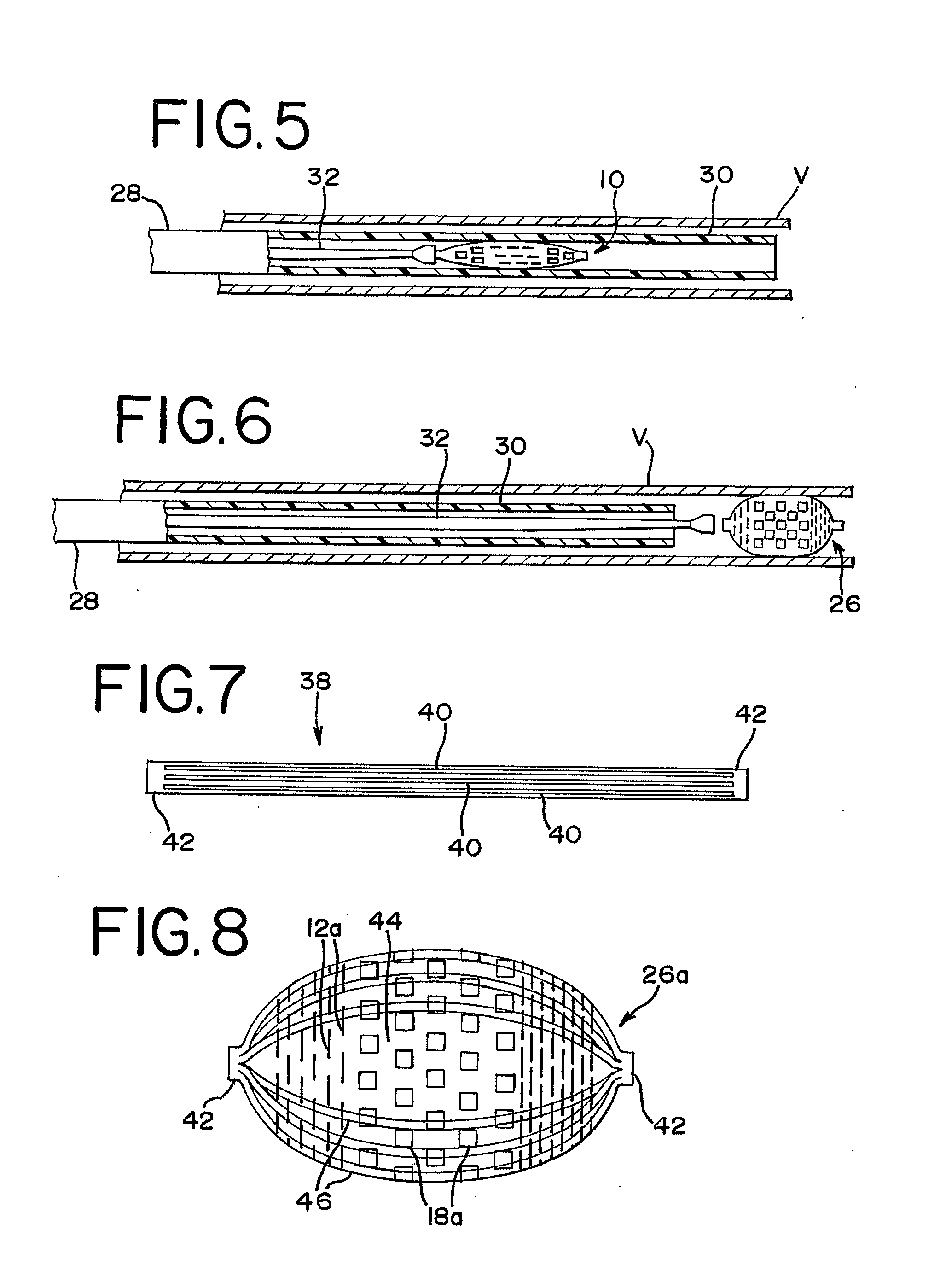 Thin Film Devices for Temporary or Permanent Occlusion of a Vessel