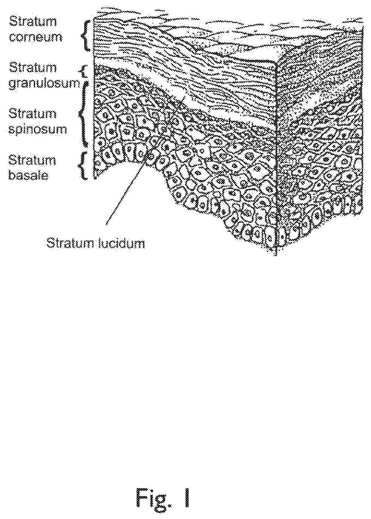 Physiological recording device or electrode