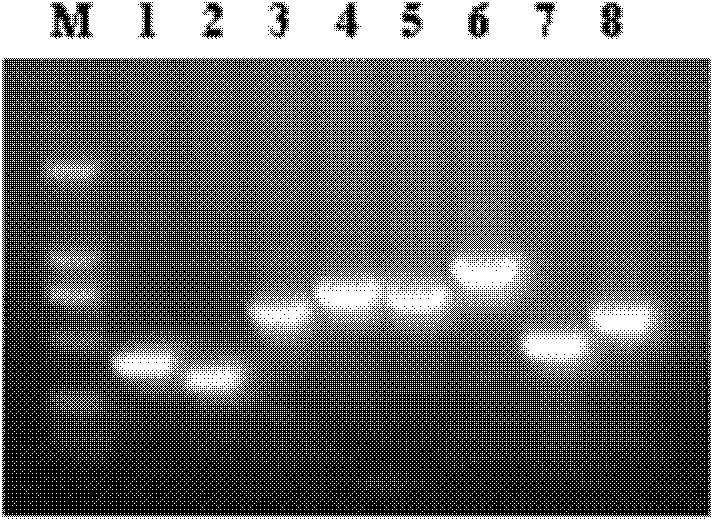 Multiple PCR detection kit for virulence factors of streptococcus suis and detection method thereof