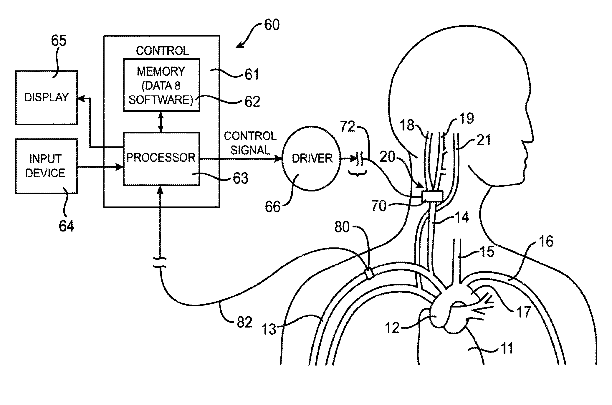 Electrode structures and methods for their use in cardiovascular reflex control