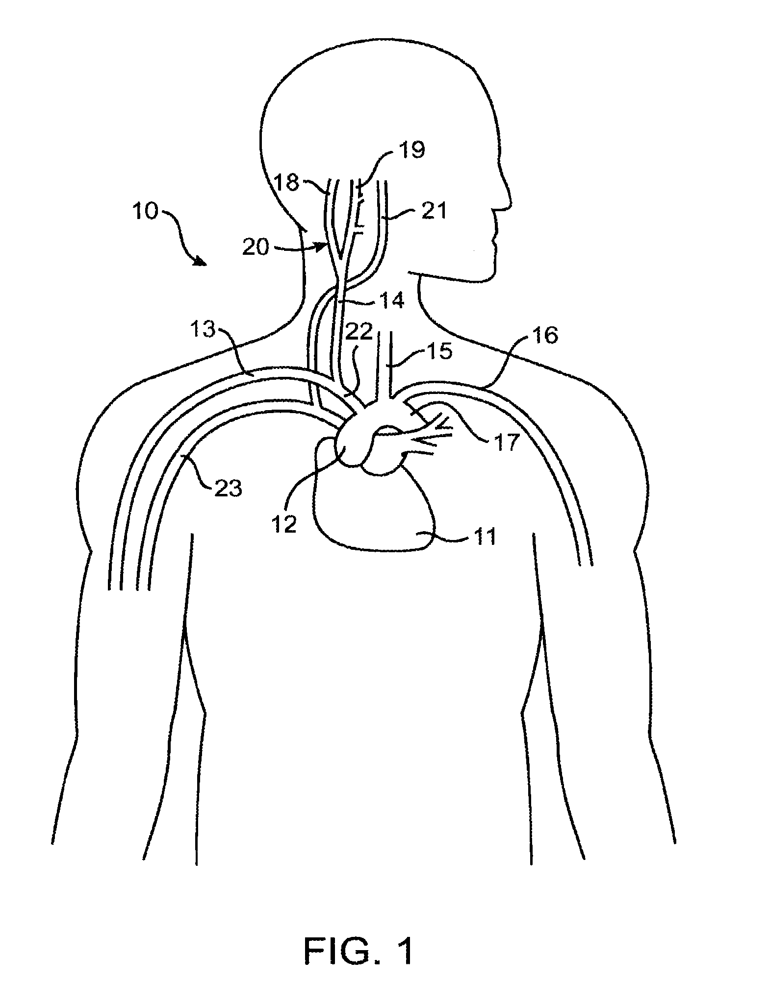 Electrode structures and methods for their use in cardiovascular reflex control