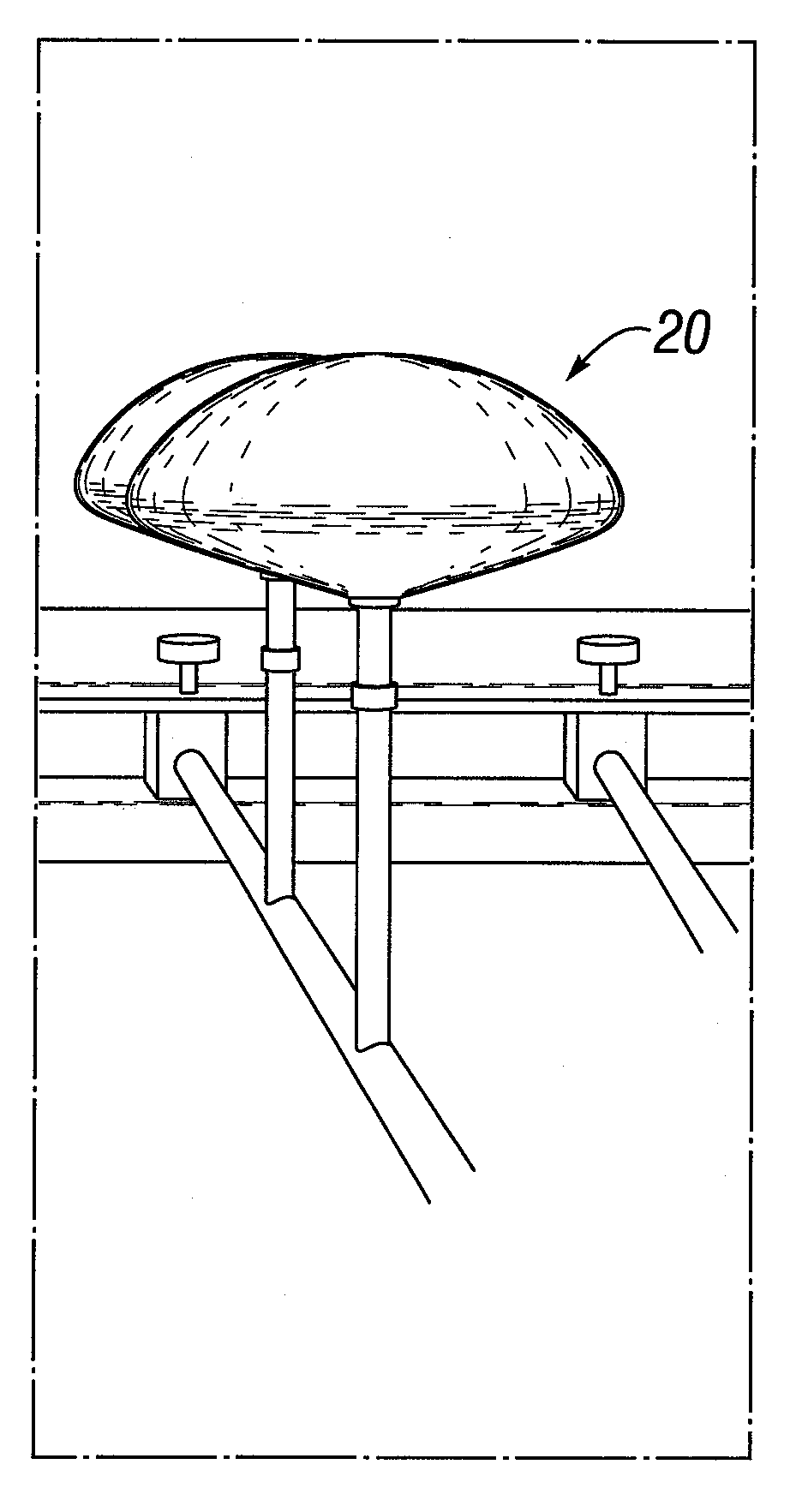 Soft prosthesis shell texturing method