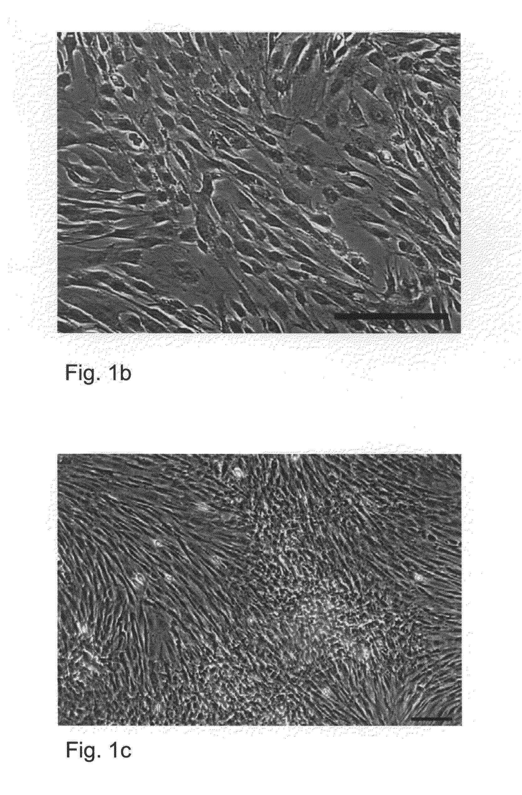 Human Embryonic Stem Cell-Derived Connective Tissue Progenitors For Tissue Engineering