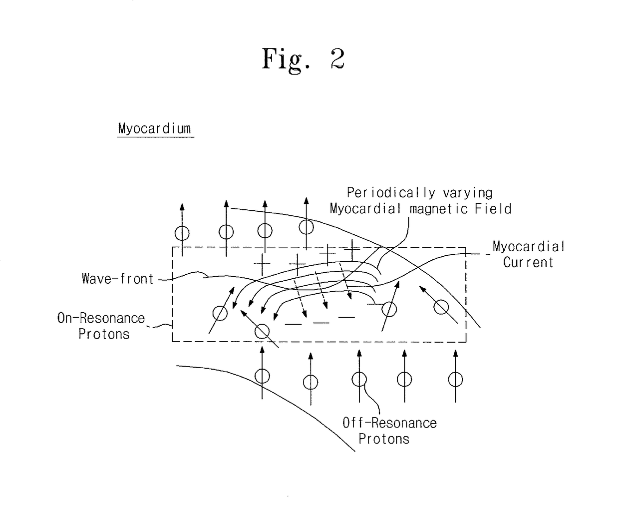 Ultra-low-field nuclear-magnetic-resonance direct myocardial electrical activity detection method and ultra-low-field nuclear-magnetic-resonance device