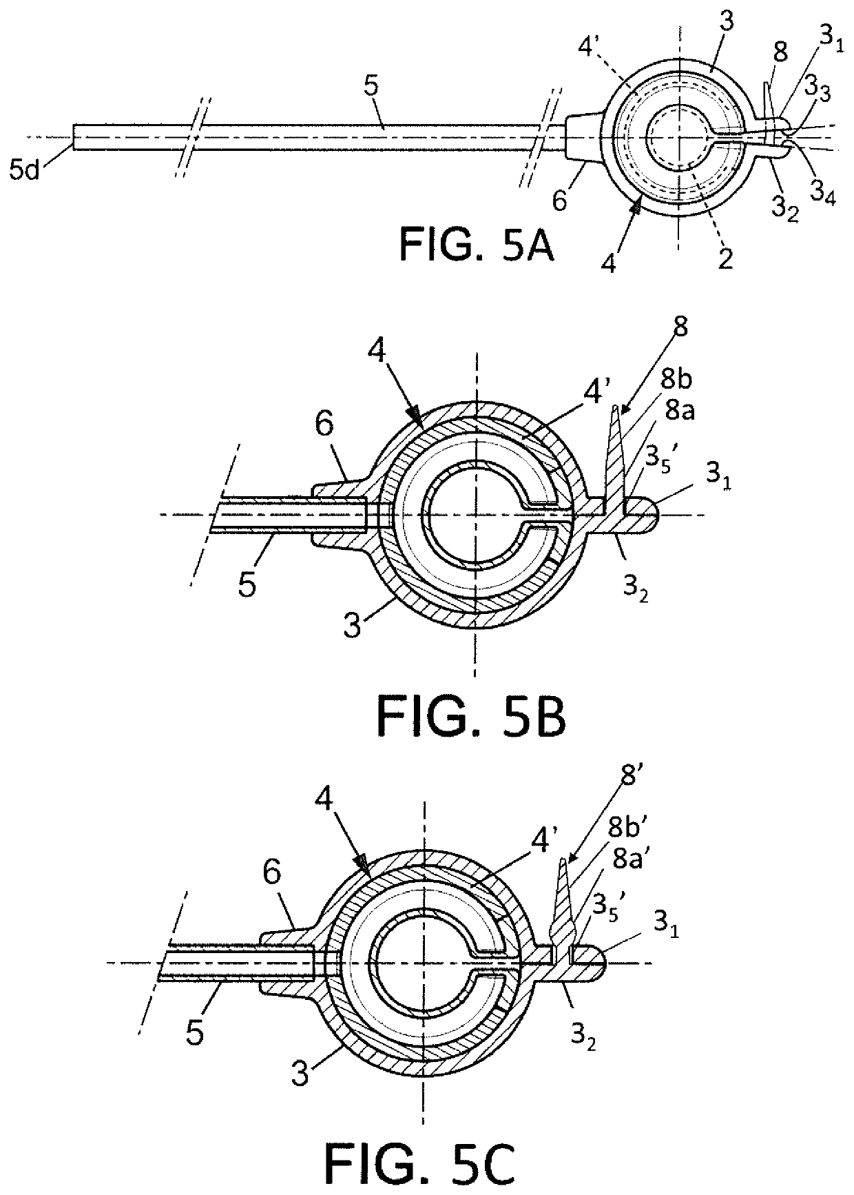 Adjustable vascular ring, means for treating SFS syndrome and implantable kit comprising such a ring