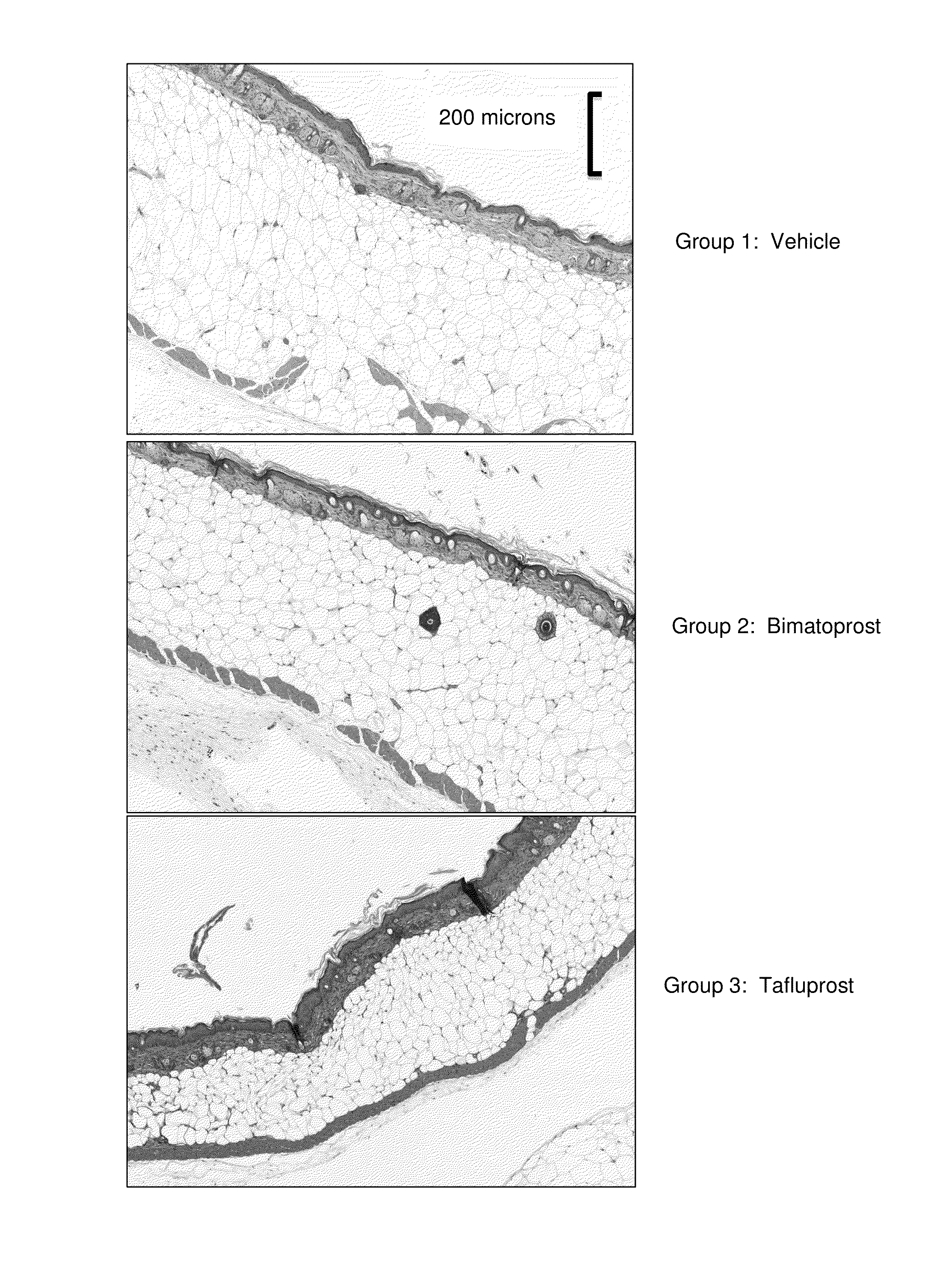 Methods and compositions for reducing body fat and adipocytes