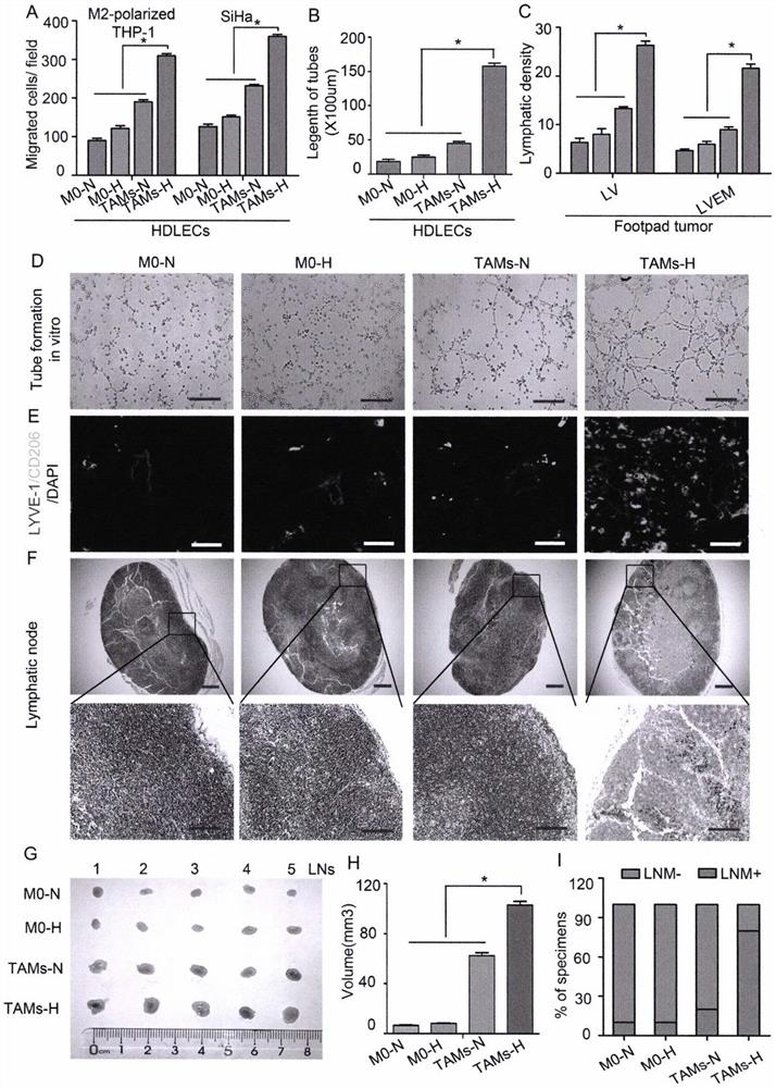 Detection and application of novel cervical cancer metastasis marker