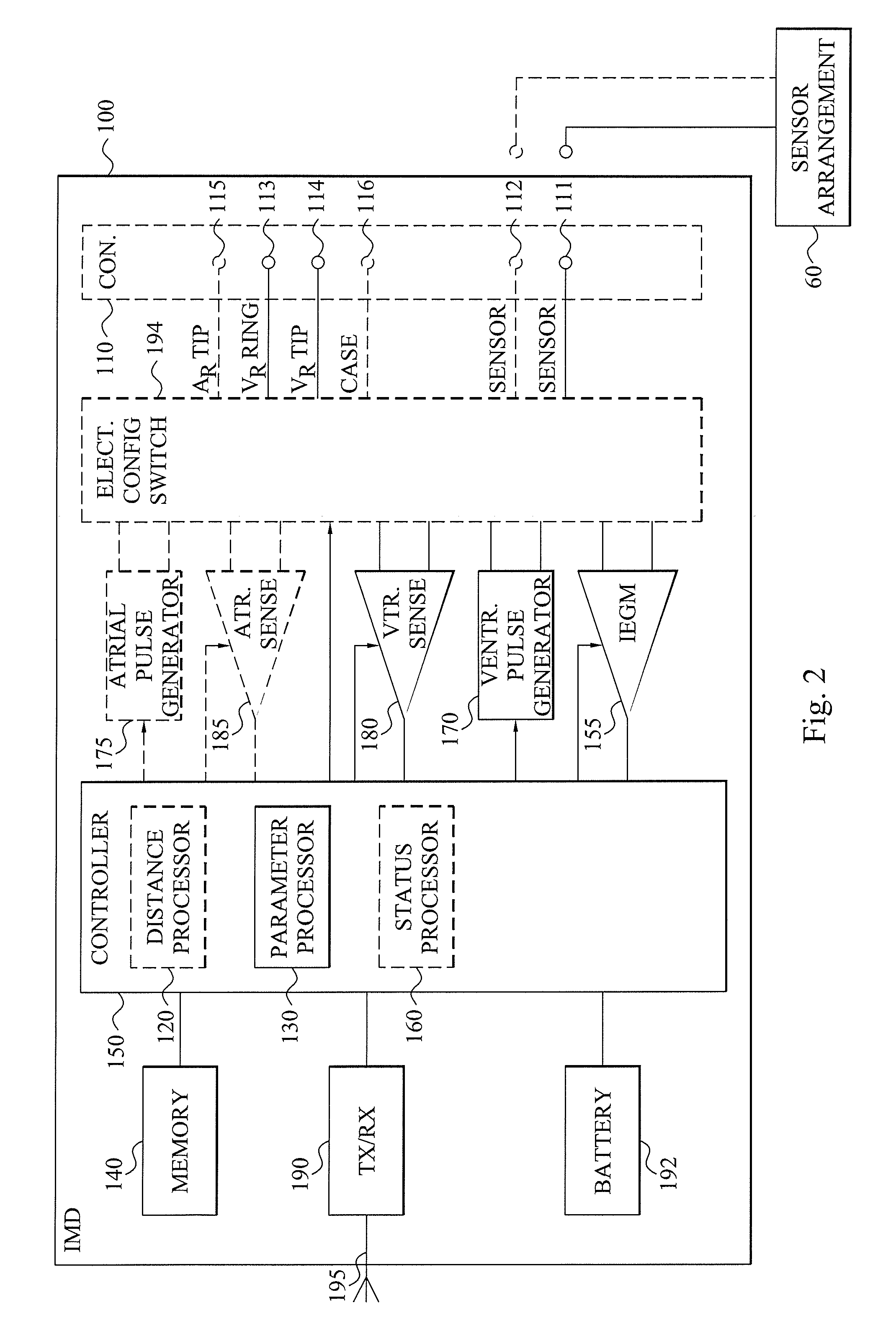 Contraction status assessment