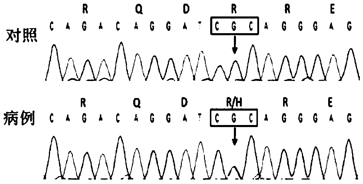 Method for detecting FUS gene mutation and TARDBP gene mutation