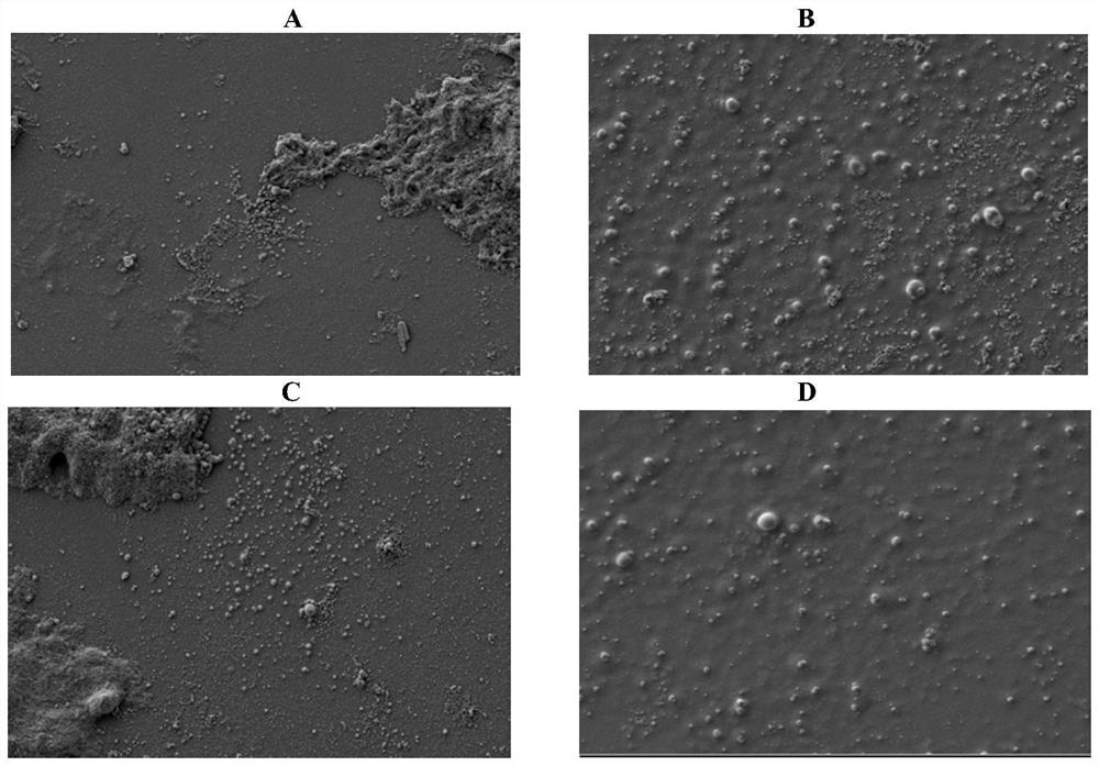 Escherichia coli VO outer membrane protein nanoparticle vaccine modified plga with chitosan and its preparation method and application