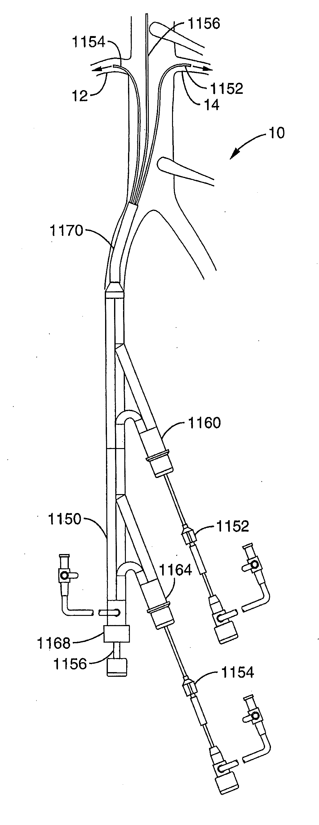 Method and Apparatus for Intra-Aortic Substance Delivery to a Branch Vessel